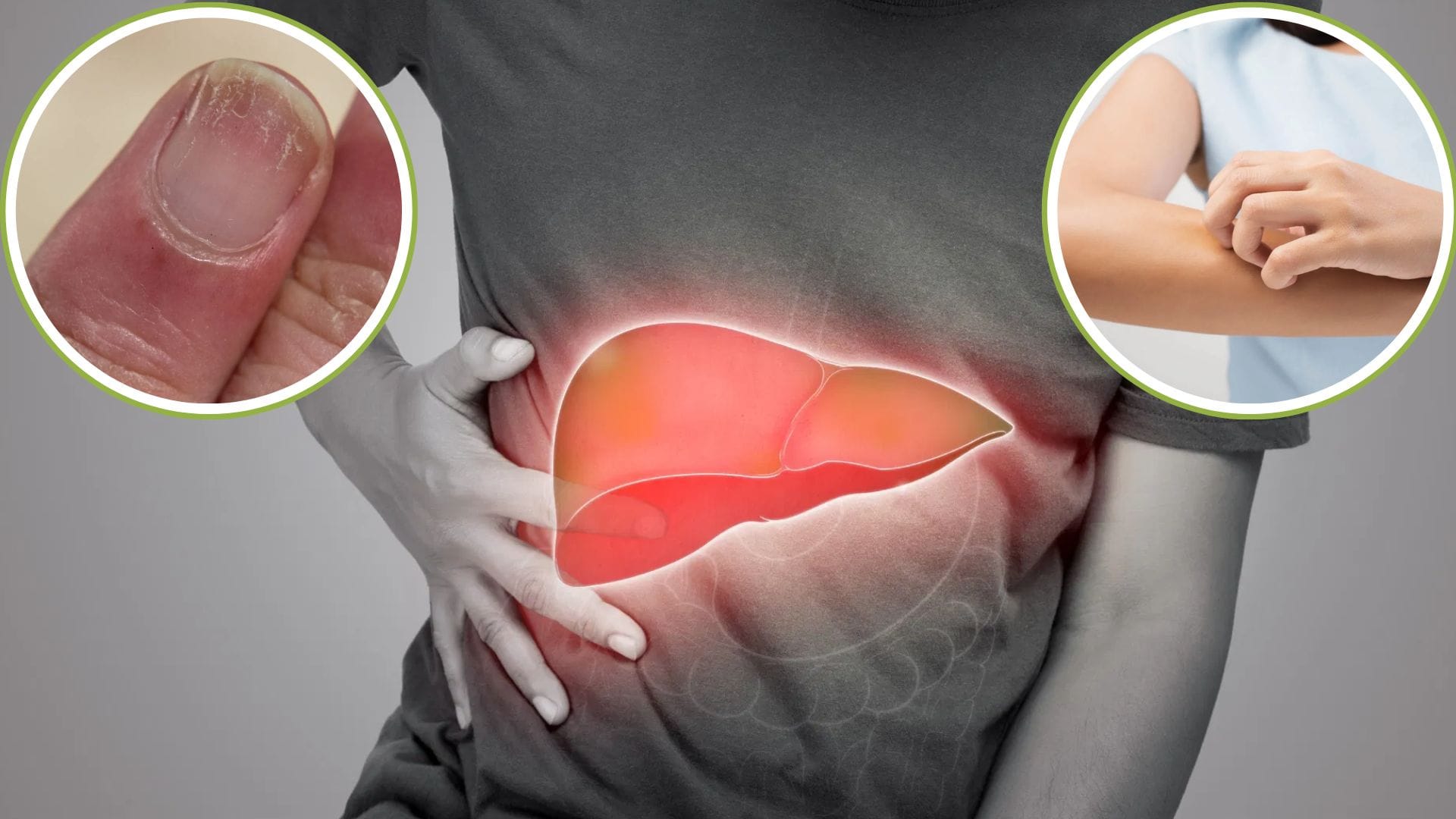 Health Tips Four Early Signs of Liver Damage People Often Ignore Check Symptoms Precautions