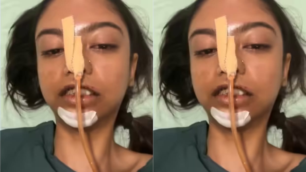Girl rides Rapido without wearing helmet meets with accident that changes everything Video Viral
