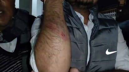 An FIR has been filed against a former state minister for holding him hostage and beating him with an iron rod