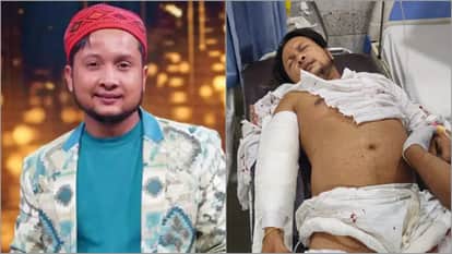 Pawandeep Rajan Recalls His Road Accident Said The Car Had Caught Fire And I Was Inside No One Was Helping