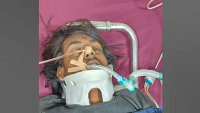 A young man fell from a flyover after colliding with a car in Hapur