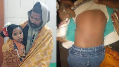 Bahraich: Wolves again attacked two innocent girls in Bahraich, injuring them.