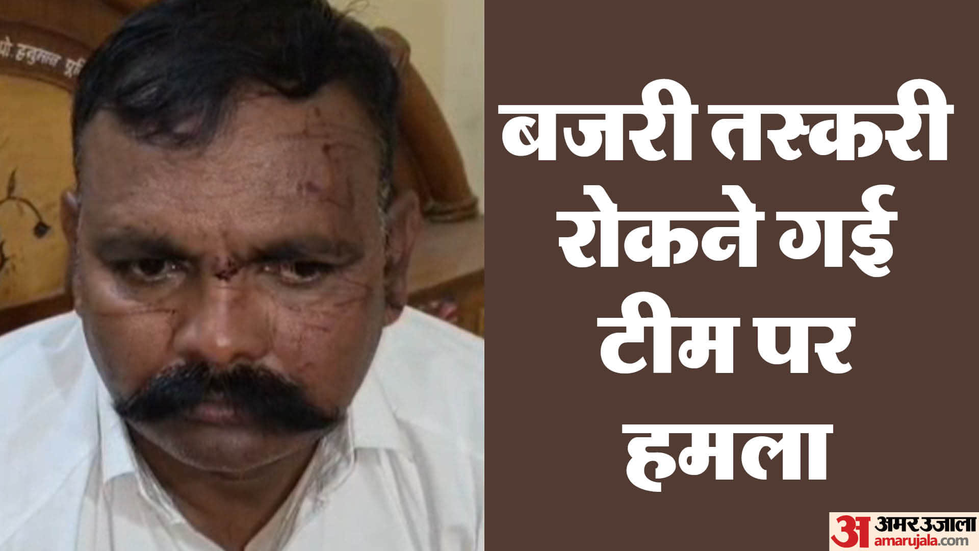 घायल पुलिसकर्मी