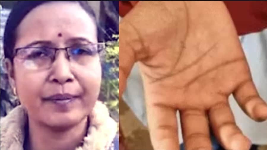 कोठरी स्कूल में शिक्षिका की बर्बरता: 8 छात्राओं को डंडों से पीटा, एक बच्ची बेहोश।