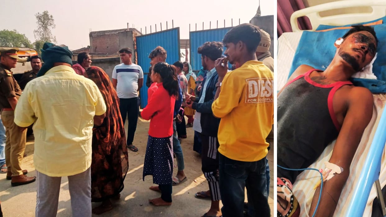 Explosion during firecracker making in azamgarh young man bleeding profusely making homemade bomb