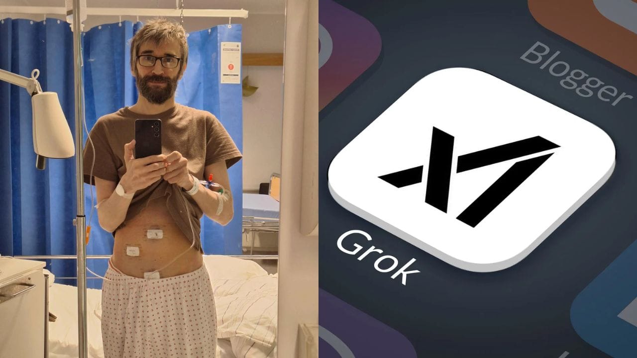 grok ai saves man from misdiagnosis of appendix elon musk shares on x
