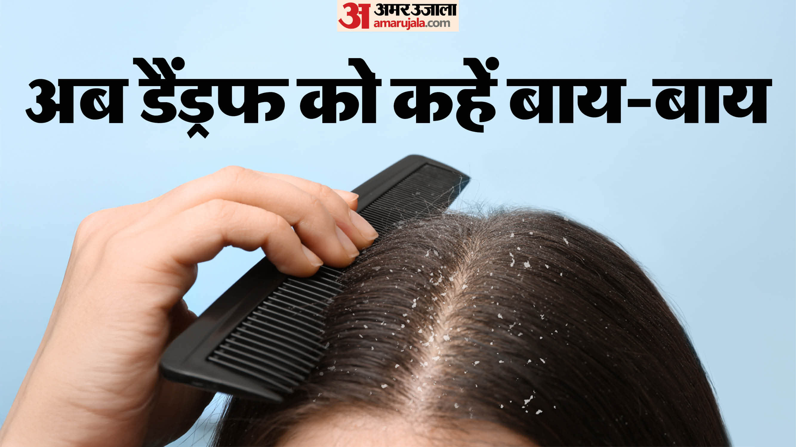 Winter Dandruff Home Remedies balon mein se dandruff hatane ke upay