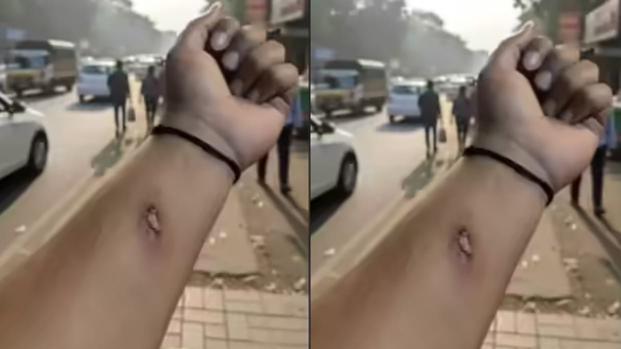 Sent a fake injury photo created using AI and got leave this employee trick backfired on HR