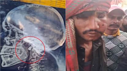 Miscreants shot a young man sitting at a shop