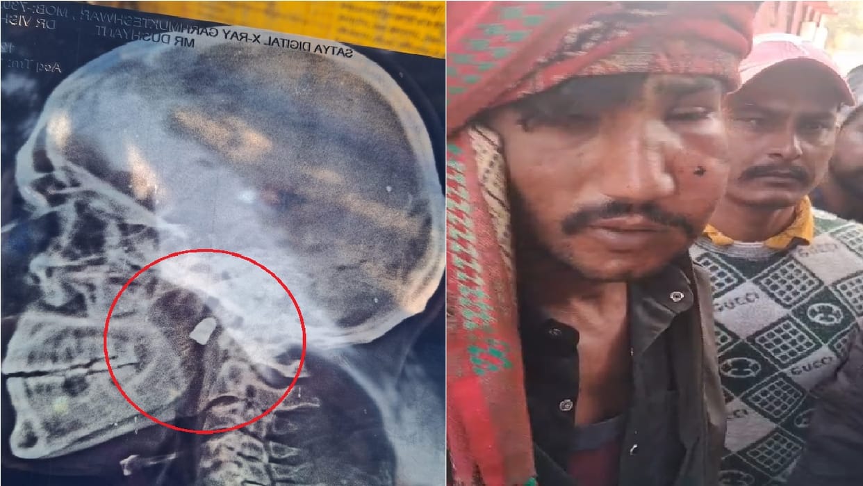 Miscreants shot a young man sitting at a shop
