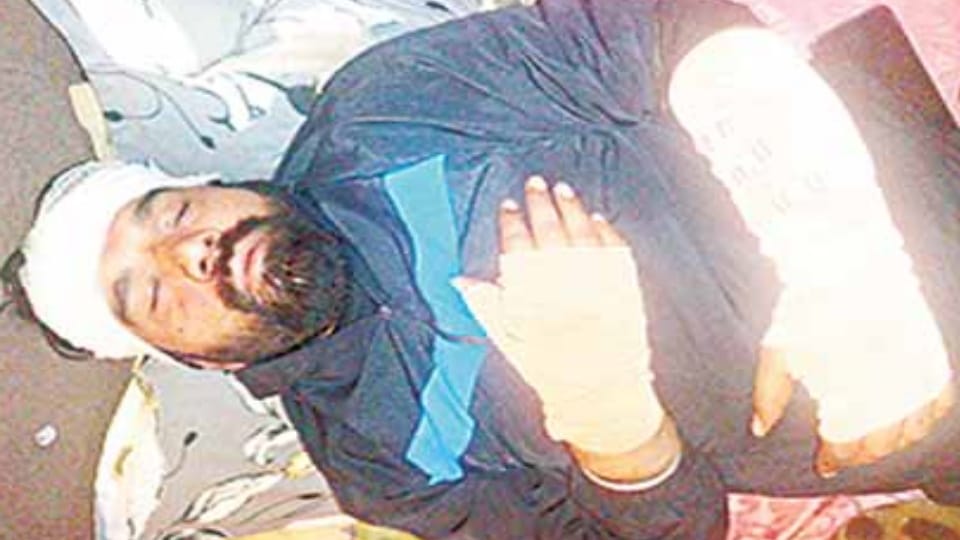 Meerut News: Hotel Operator Brutally Attacked on Rohta Road, Both Arms Fractured