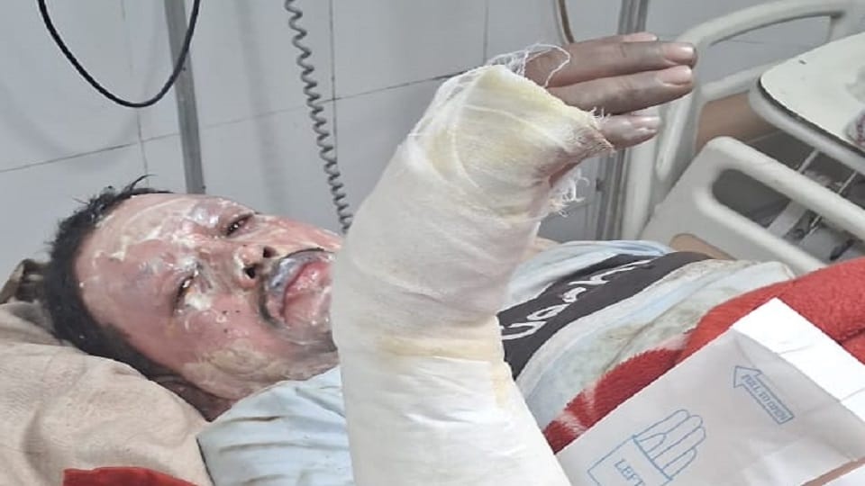 One worker died in Boiler explosion at Rohtak