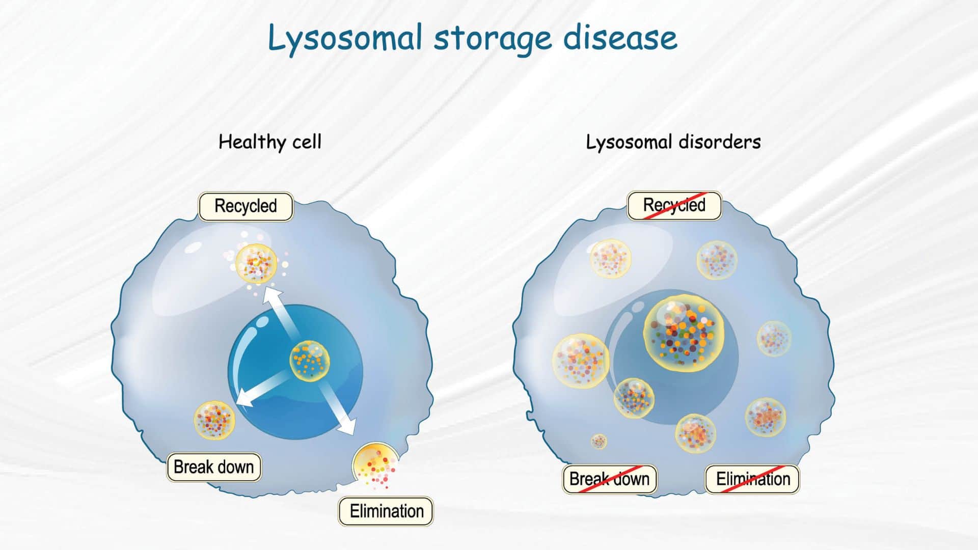 लाइसोसोमल स्टोरेज डिसऑर्डर