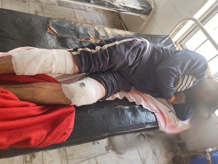 Bihar Police: मुठभेड़ में कुख्यात को पुलिस ने पैर में मारी गोली, STF के साथ मिलकर की गई ये कार्रवाई