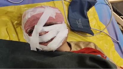 sister-in-law launched deadly attack on her husband sister in Agra