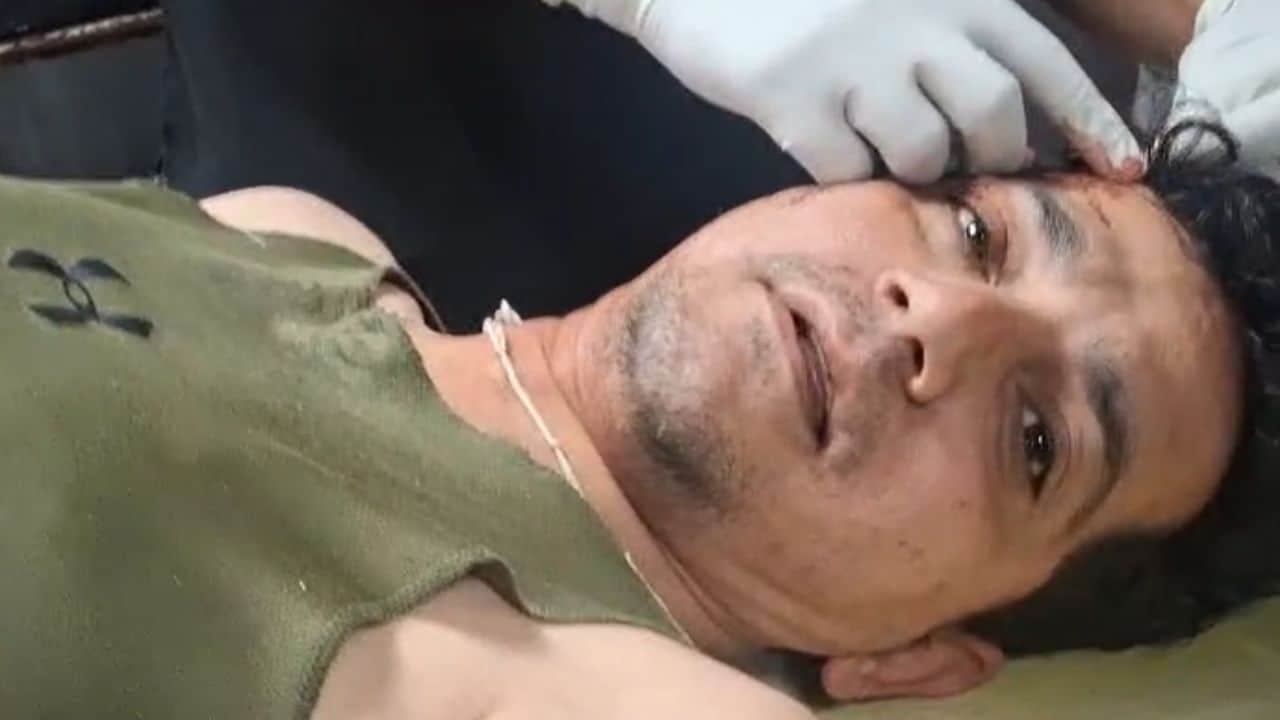 जीएमसी में भर्ती घायल एसआई नितिन खजूरिया।