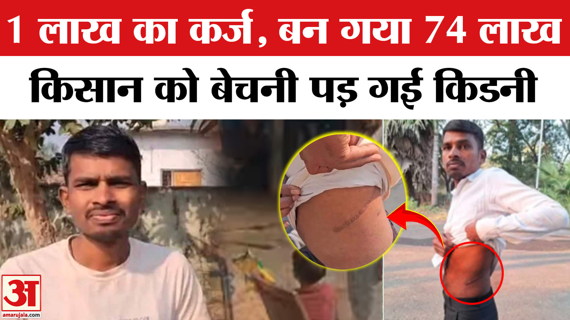 किसान को बेची किडनी