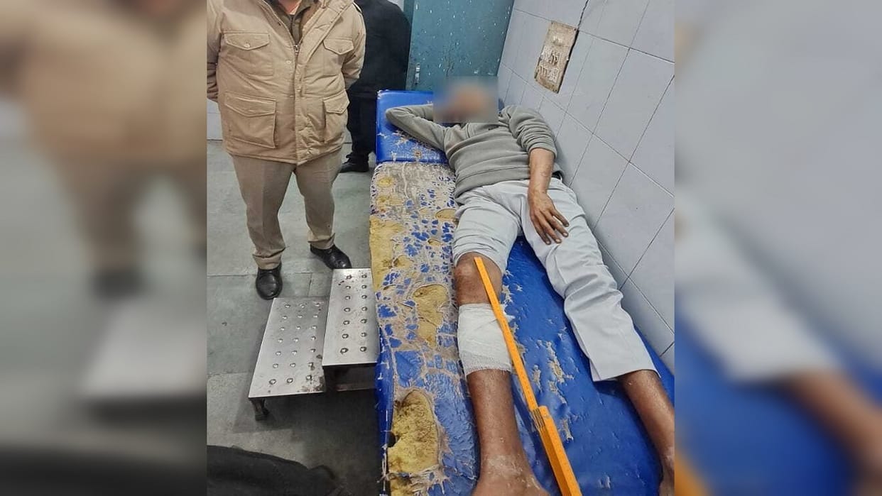 Fake currency printing criminal carrying a reward of Rs 10000 arrested after encounter
