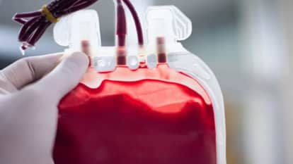 Bikaner News: Patient Given Wrong Blood at PBM Hospital, Woman’s Condition Worsens; Inquiry Ordered