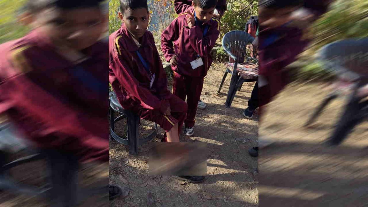 Bear attacked a student on way to school in Pokhari Gopeshwar Chamoli News Uttarakhand