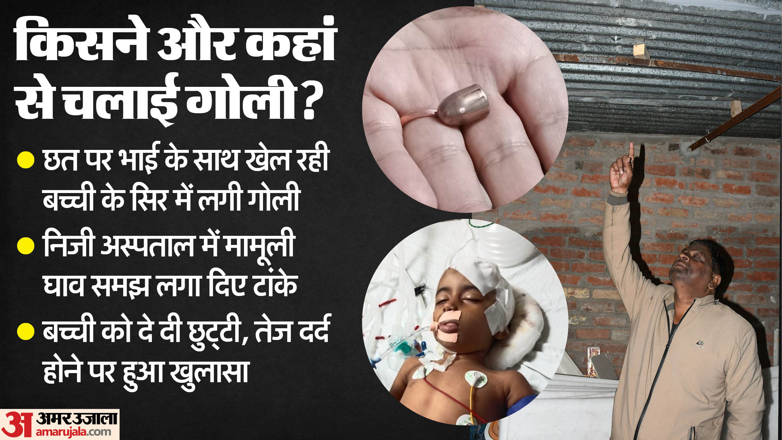 Bullet hit girl head Who playing on roof doctor stitched up wound mistaking minor injury in lucknow