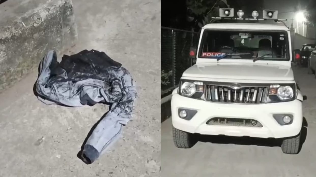 Bihar News : acid attack on woman beauty parlor owner mokama patna bihar police love affair