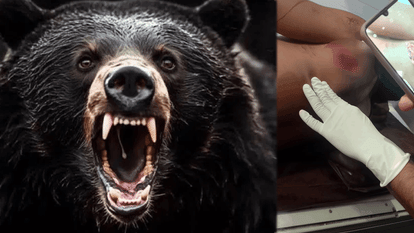 teacher was suddenly attacked by a bear while returning home from school