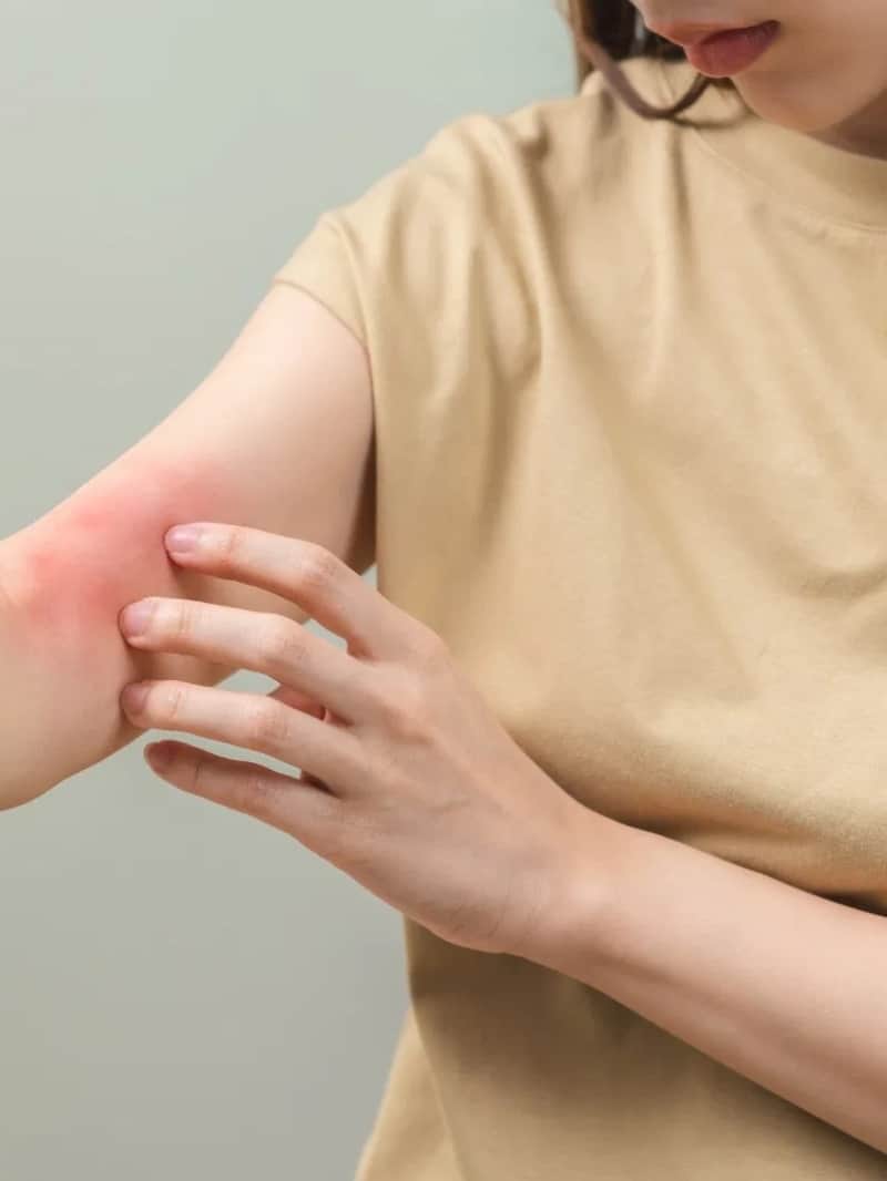 itching