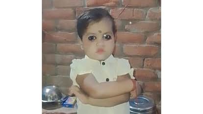 Girl burnt in bonfire dies during treatment