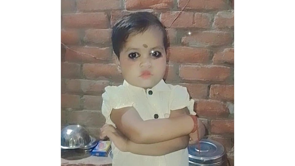 Girl burnt in bonfire dies during treatment