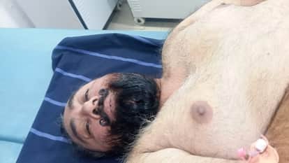 Congress leader and former councilor shot at in Moga