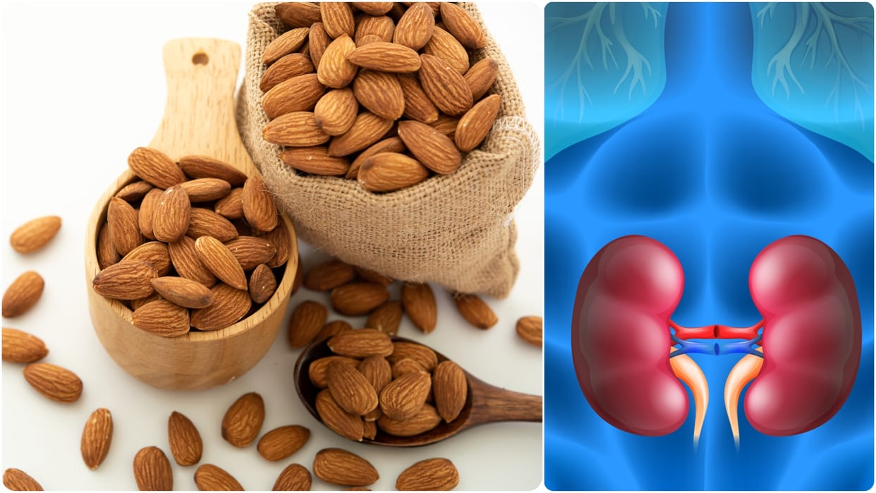can eating too many almonds cause kidney stones jyada badam khane ke nuksan