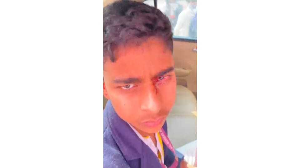 Teacher throws duster at student, injures in the eye