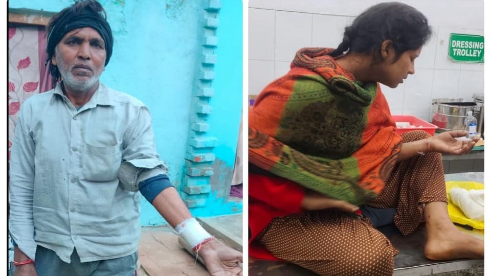 Baghpat: Mad dog bit seven people including BA student, when it pounced on the child, people beat him to death