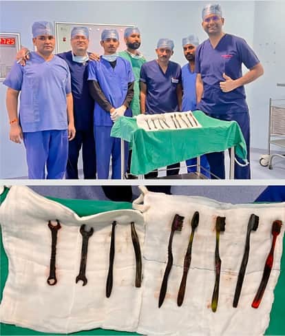 Jaipur Rare Surgery: 7 Toothbrushes, 2 Iron Objects Removed from Patient’s Stomach