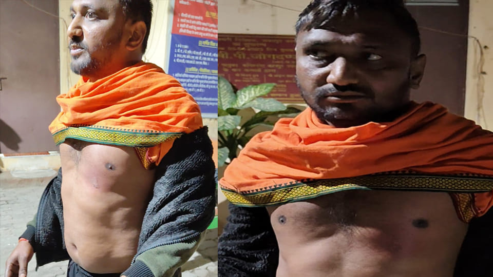 Kanpur: Argument over payment for momos leads to man being attacked with boiling oil