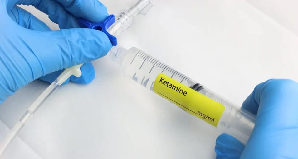 Kanpur Ketamine Therapy Suicidal thoughts disappear after just one dose GSVM prepares details of 30 patients