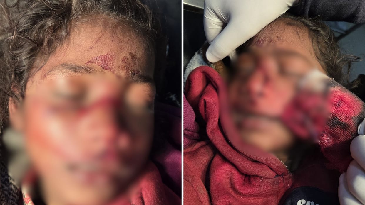 Girl beaten and thrown to ground wasn enough stabbed in face brutality over a land dispute in azamgarh