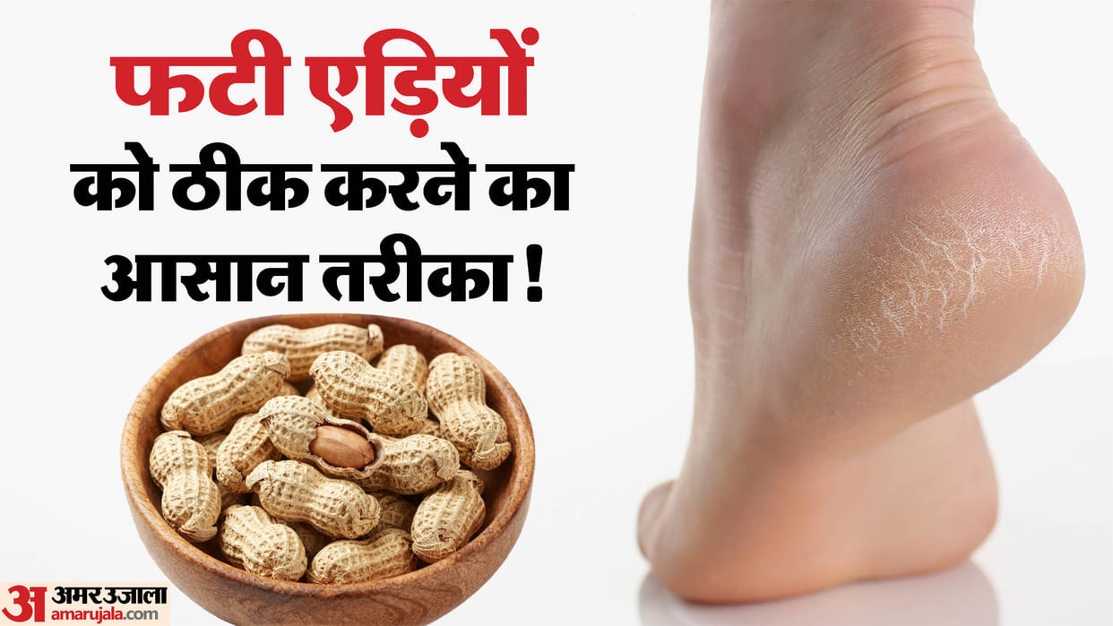 Cracked Heels Remedy How Peanut Shell Can Help Heal Dry and Cracked Feet Fati Adiyo Ke Upay