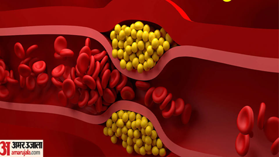 UP: Hormonal Balance Disrupted Due to Attempts to Lower Cholesterol