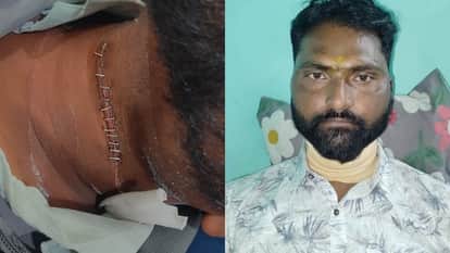 Chhindwara News: A jewelry seller's throat was cut by Chinese kite string lying on the road.