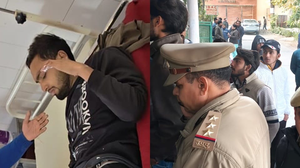 Moradabad: Student attacked with a petrol bomb at Hindu College; his friends saved his life