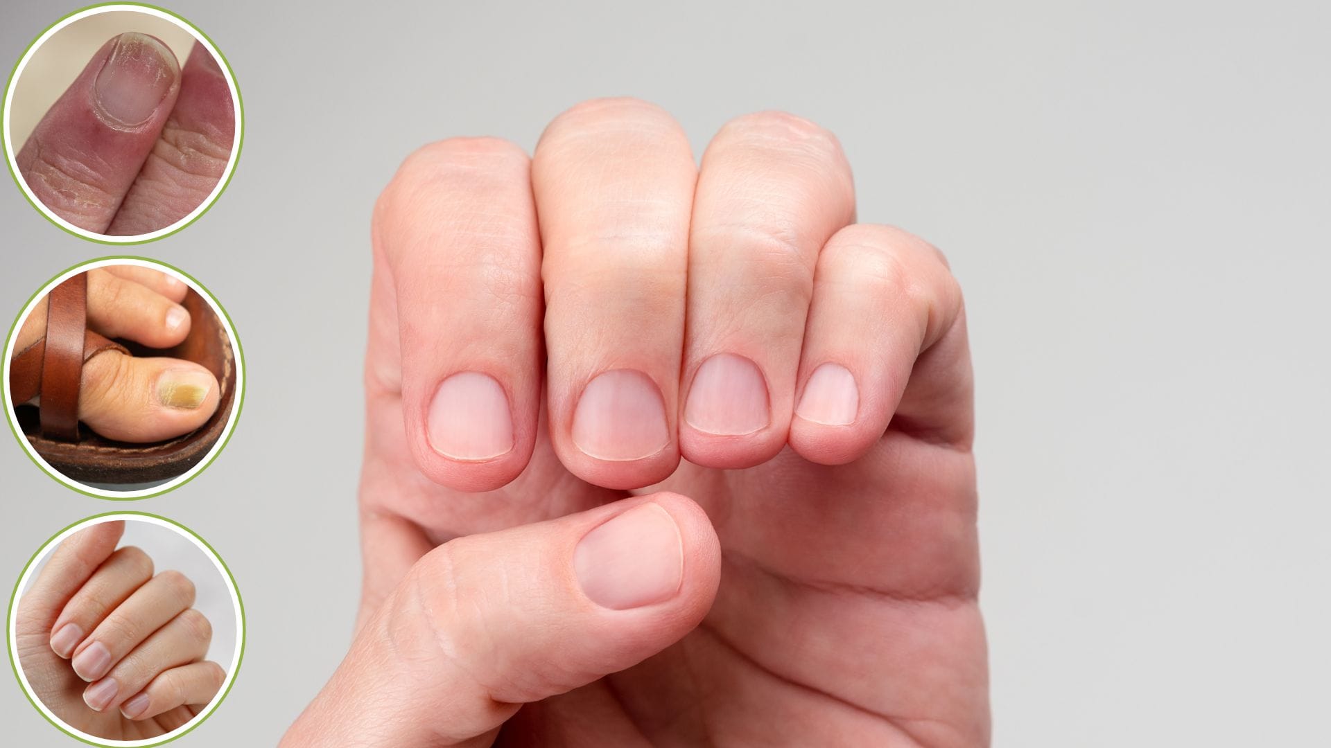From Color to Shape Nail Changes Doctors Say May Signal Serious Diseases