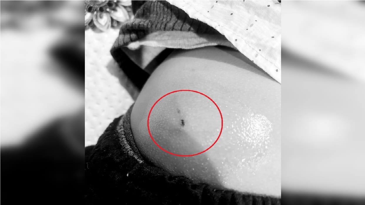 Eight year old boy bitten by four dogs in Greater Noida