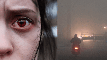 number of eyes patients increased by 20 to 30 percent With increasing cold in Delhi