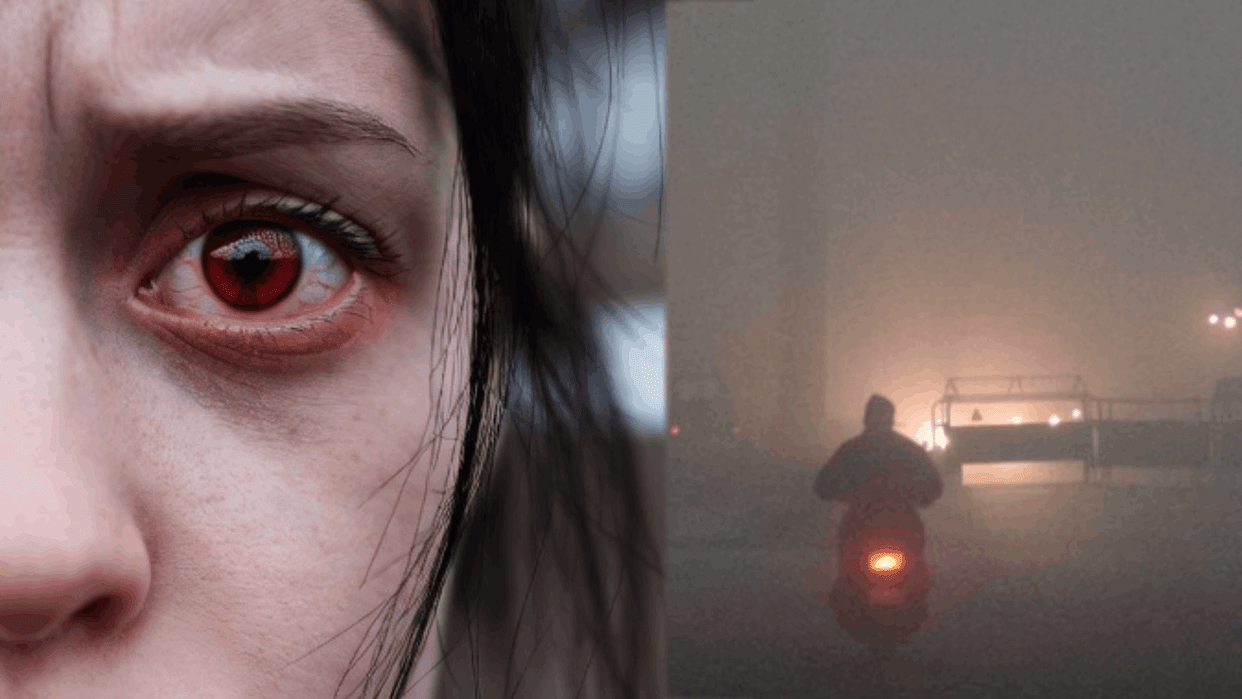 number of eyes patients increased by 20 to 30 percent With increasing cold in Delhi