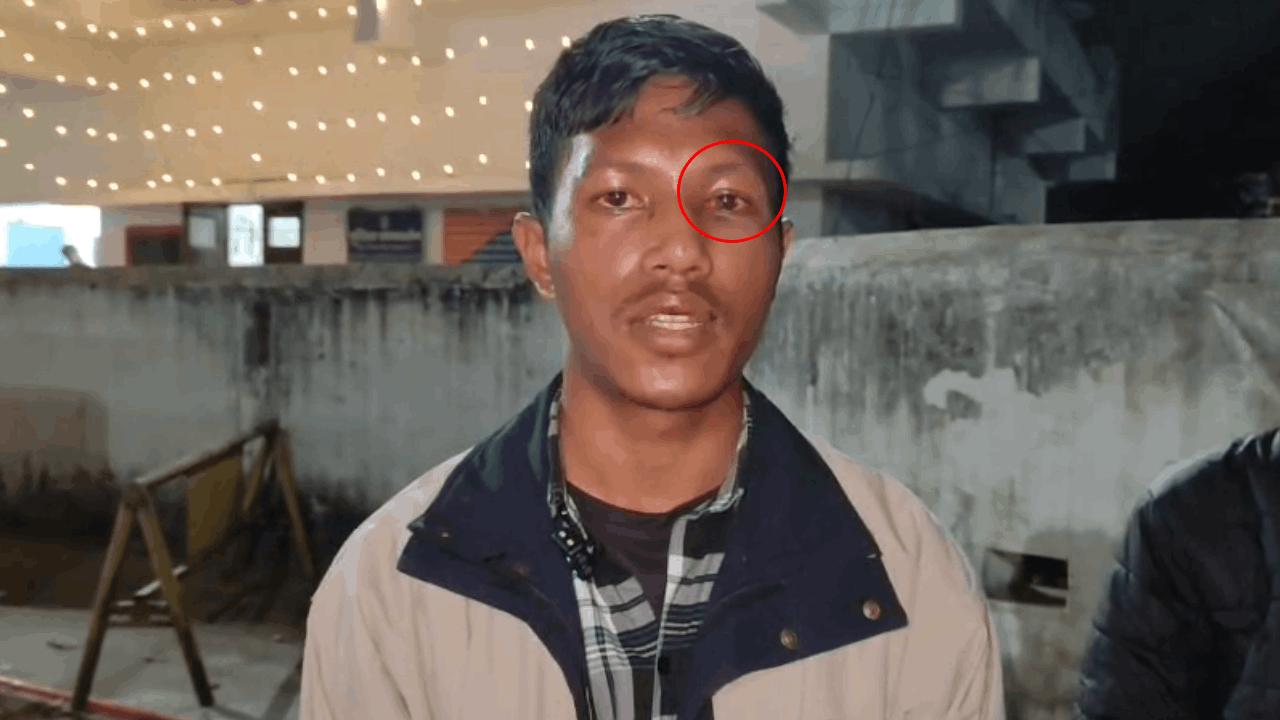 छात्रावास में छात्रों के बीच मारपी