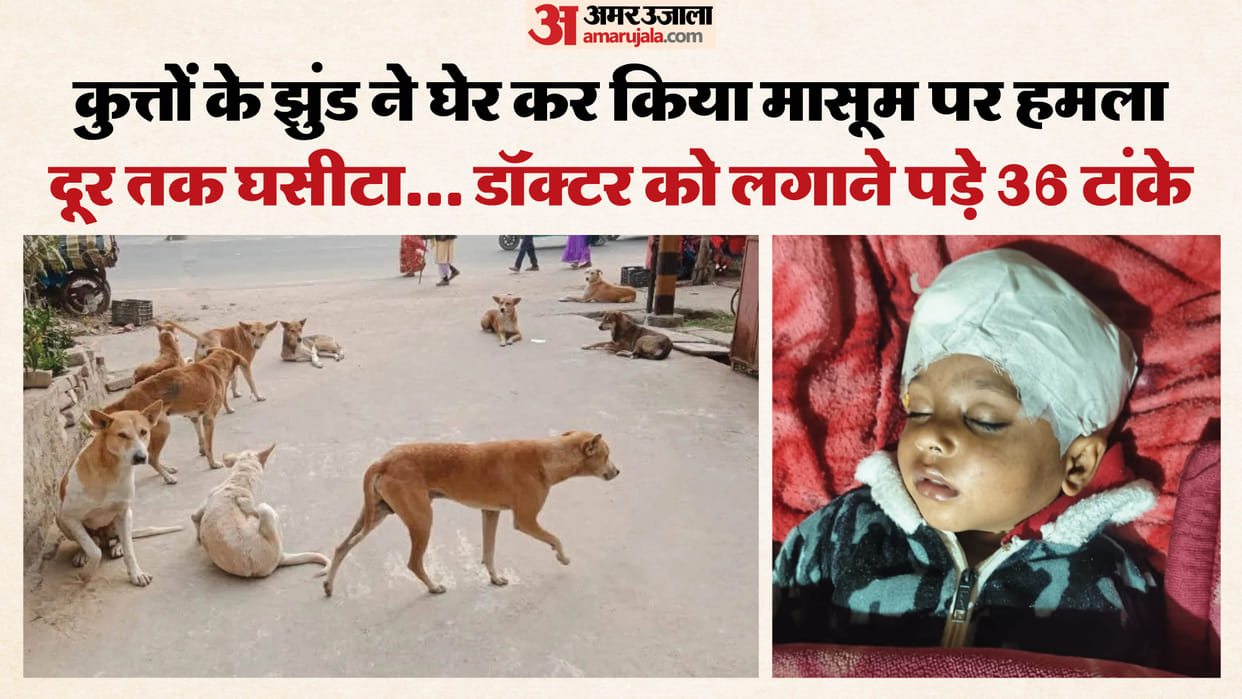 dogs attacked child in Indirapuram requiring 36 stitches on his head