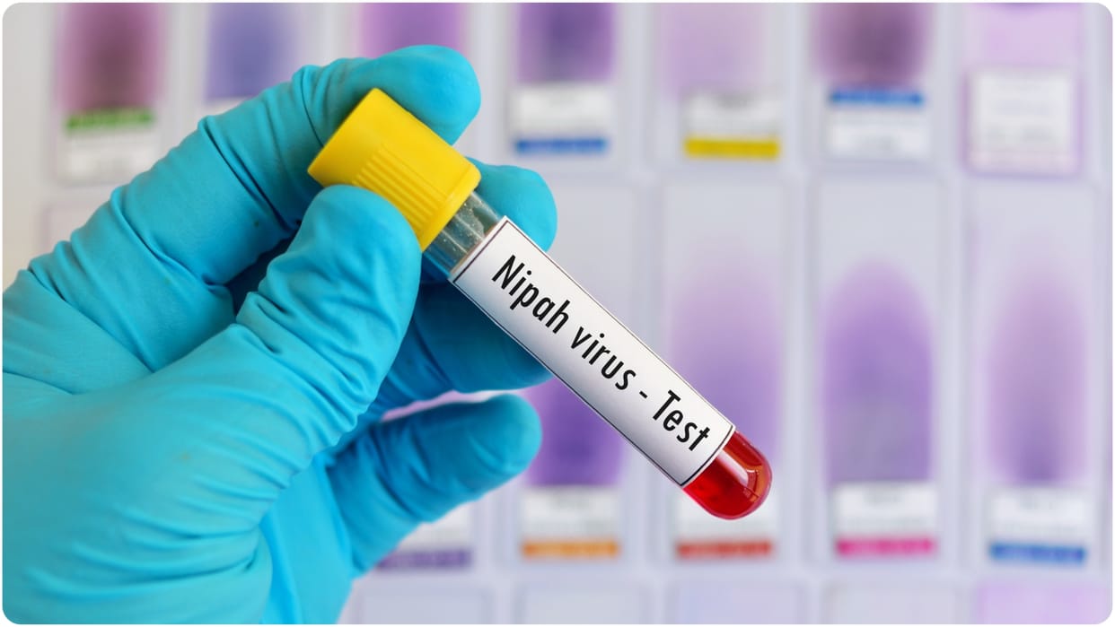 Nipah Virus: Condition of One Nipah-Infected Nurse Improves, Other Remains Critical in West Bengal
