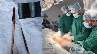 son shot his father with two arrows and received successful treatment in Mekaj